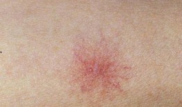 你好红痣爆料视频完整版,完整版内容深度解析